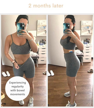 Before & After Results: Naturally debloat for good with Follow Your Gut