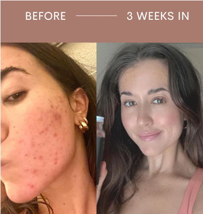 Powerful Ingredients With Powerful Results